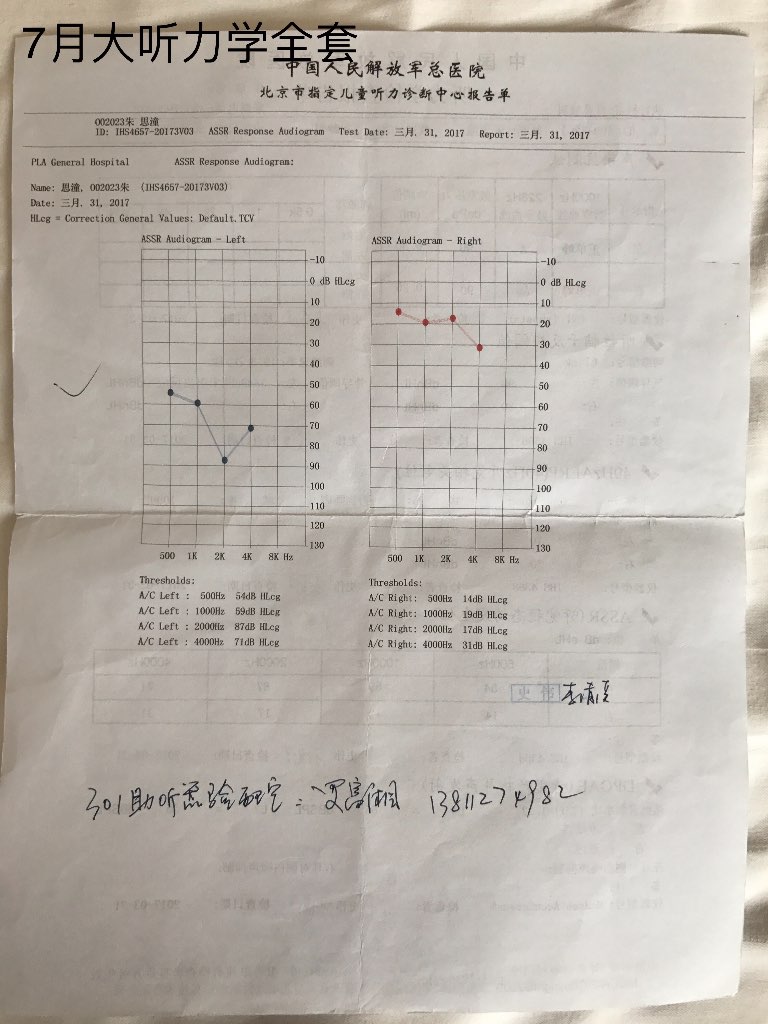 出生及42天左耳听力筛查没通过,宝宝3月大时测试电耳镜发现有鼓室积液