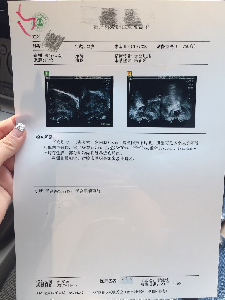 子宫肌瘤图片彩超图片